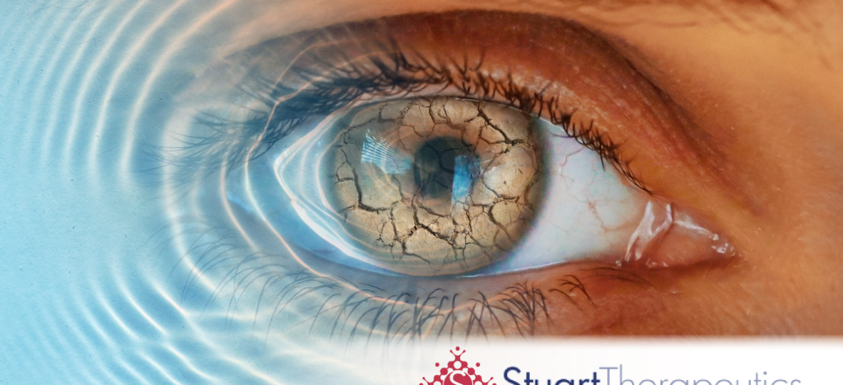 [Internal] Stuart Pharma Clinical Trial Thumbnail 3