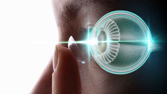 RGPs for myopia progression 01