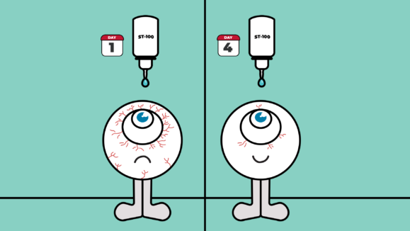 stuart dry eye drug ig thumbnail